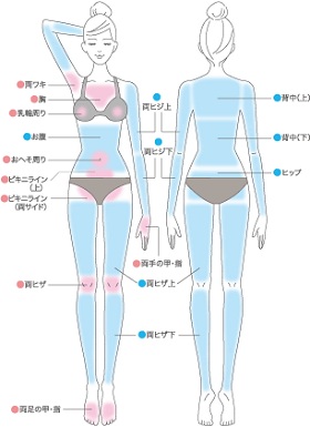 全身脱毛プラン図解